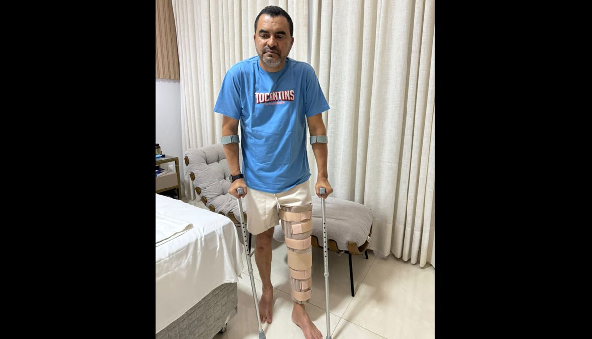 Governador Wanderlei Barbosa rompe ligamentos do joelho e passará por cirurgia